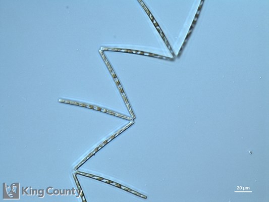 Photo of Thalassionema nitzschioides